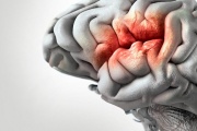 Día Mundial del Accidente Cerebrovascular (ACV): Urgente Concienciación en la Población Argentina