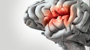 Día Mundial del Accidente Cerebrovascular (ACV): Urgente Concienciación en la Población Argentina