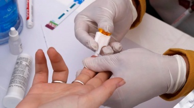 Hoy Empiezan los Testeos Gratuitos de HIV y Sífilis