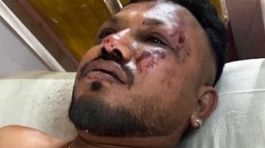 El Único Sobreviviente Del Vuelo De Air India Relata El Horror: "Pensé Que Yo También Iba A Morir"