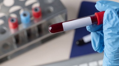 Japón Desarrolla Sangre Artificial Universal Con Vistas A Su Uso Clínico Para 2030