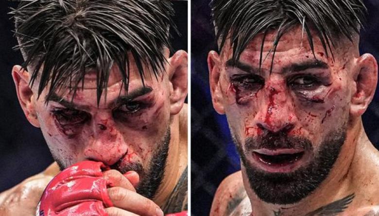 Ilia Topuria perdió ante Justin Gaethje en una polémica velada de UFC en la Casa Blanca