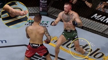 McGregor fue operado con éxito de la fractura y volvió a desafiar a Poirier
