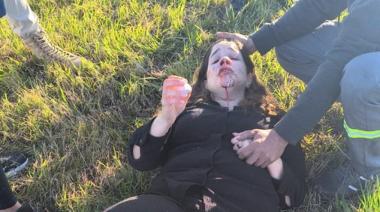Accidente en la Autopista Buenos Aires-Rosario: Una Diputada Libertaria Resultó con Heridas Leves