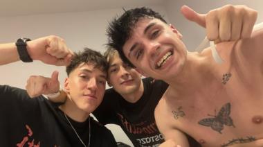 Mernuel mostró las secuelas de su pelea en Párense de Manos III: "Diente roto y ojo morado" 🥊🩹